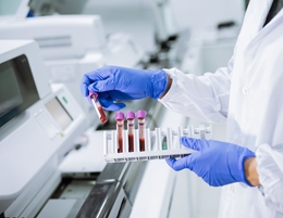 Maintenance Guidelines for Hematology Analyzers